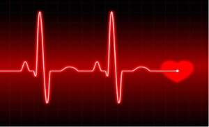 arritmia_cardiaca arritmia_cardiaca